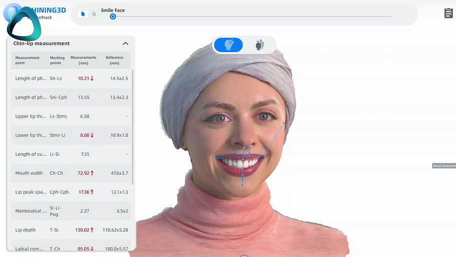 idd-institute-of-digital-dentistry-metismile-3d-dental-facial-scanner-review-shining-3d-fs-launcher-software-ui.png