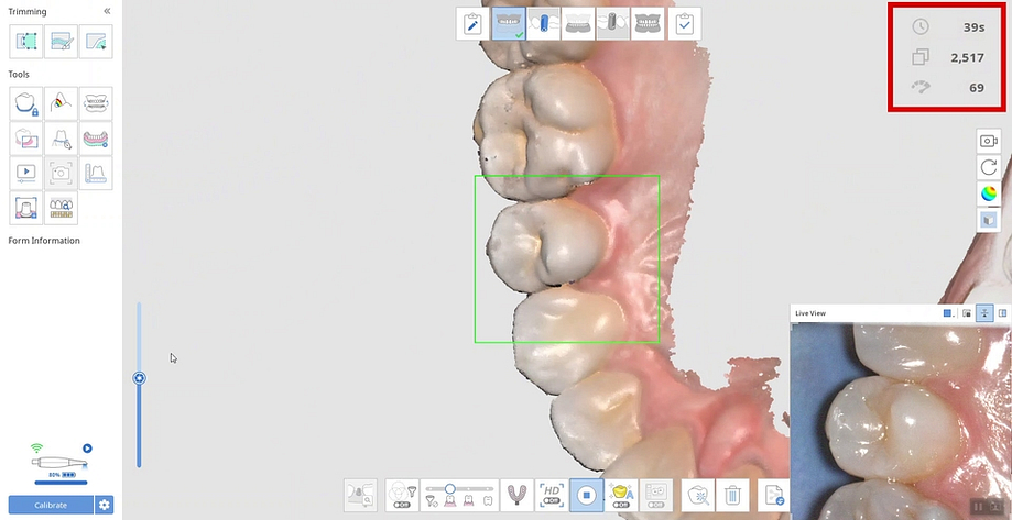 medit i600 fps scan