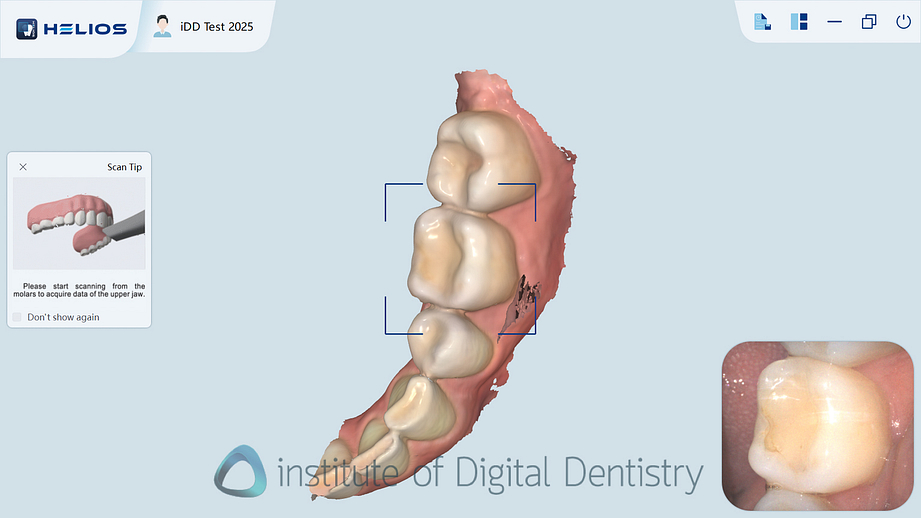helios_500_review_intra_oral_scanner_iDD8
