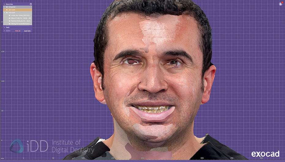 face_scanner_review_dentistry_iDD26