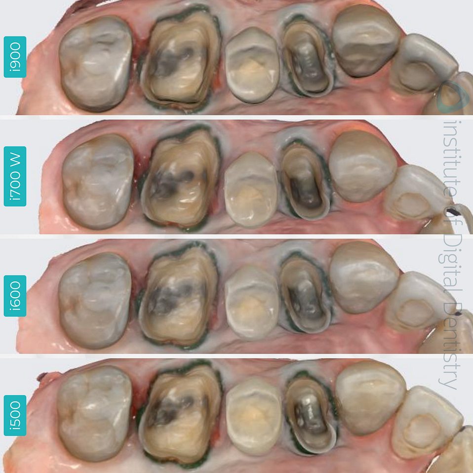 medit-intraoral-scanner-i500-i600-i700-wireless-i900-idd-compares-institute-of-digital-dentistry-native-color-scan