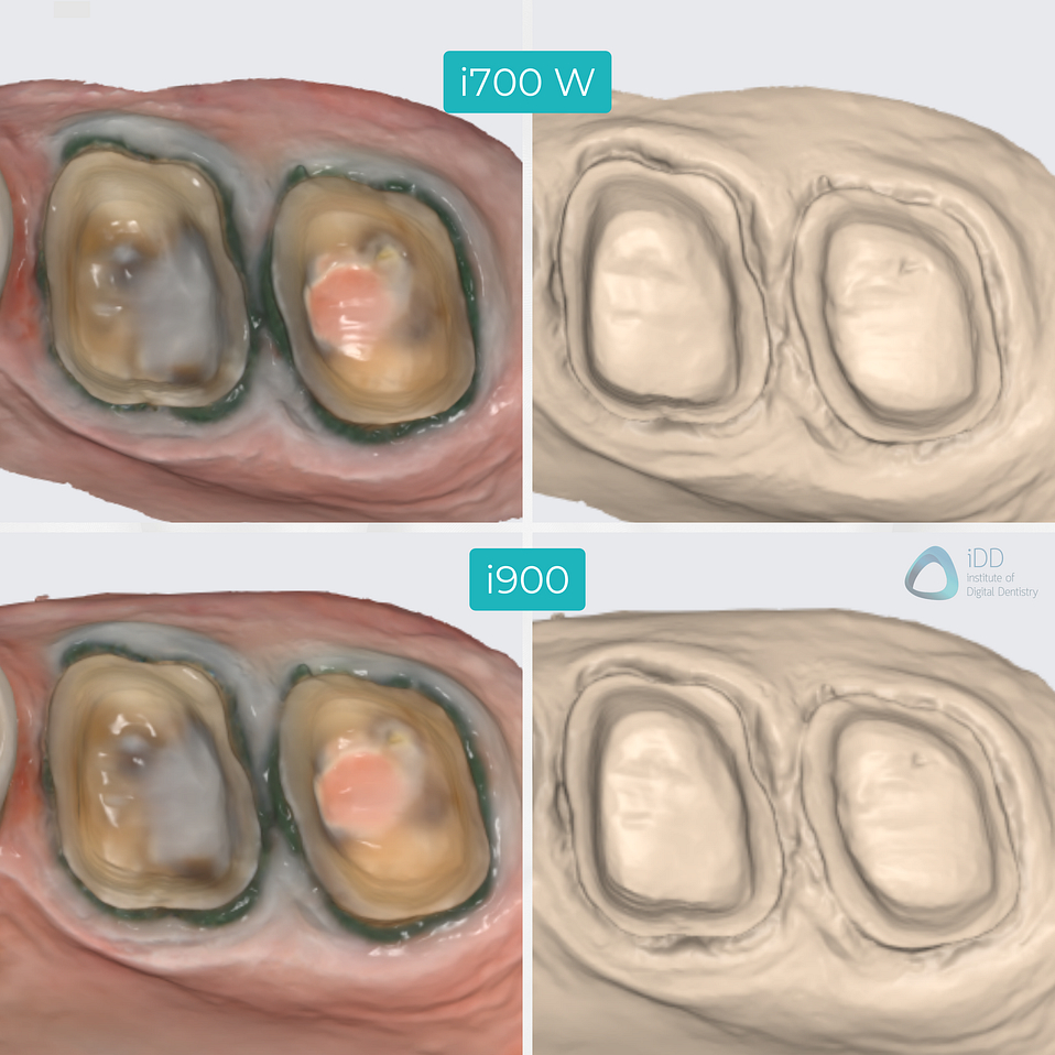 medit-intraoral-scanner-i700-wireless-i900-idd-compares-institute-of-digital-dentistry-native-color-monochrome-scan