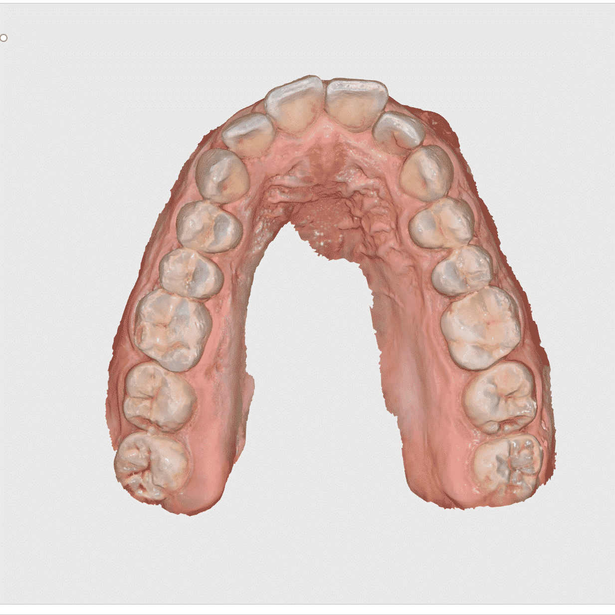 full-arch-scan-medit