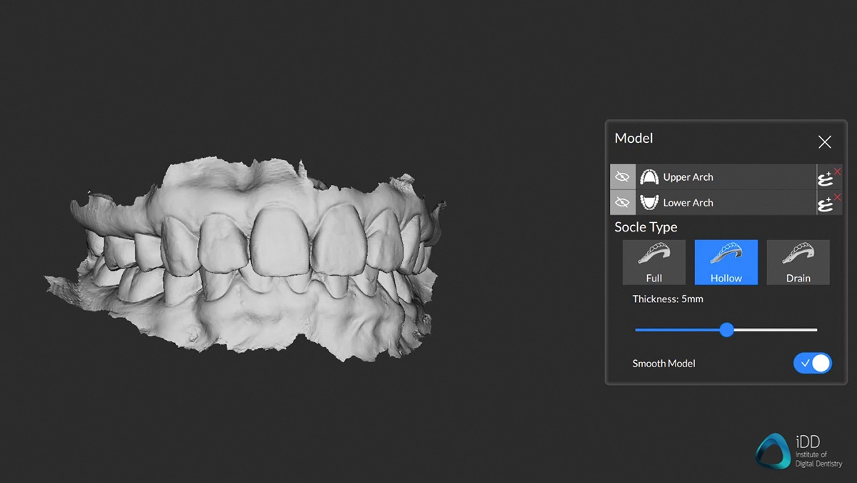 CS scan flow software institute of digital dentistry (2)