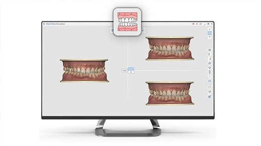 Medit orthodontic simulation