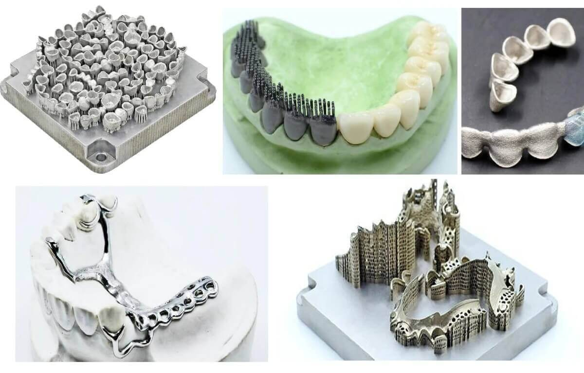 Examples of Dental 3D Printing Materials