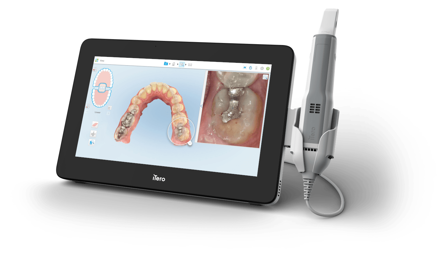 itero element 5d scanner mobile version plus series