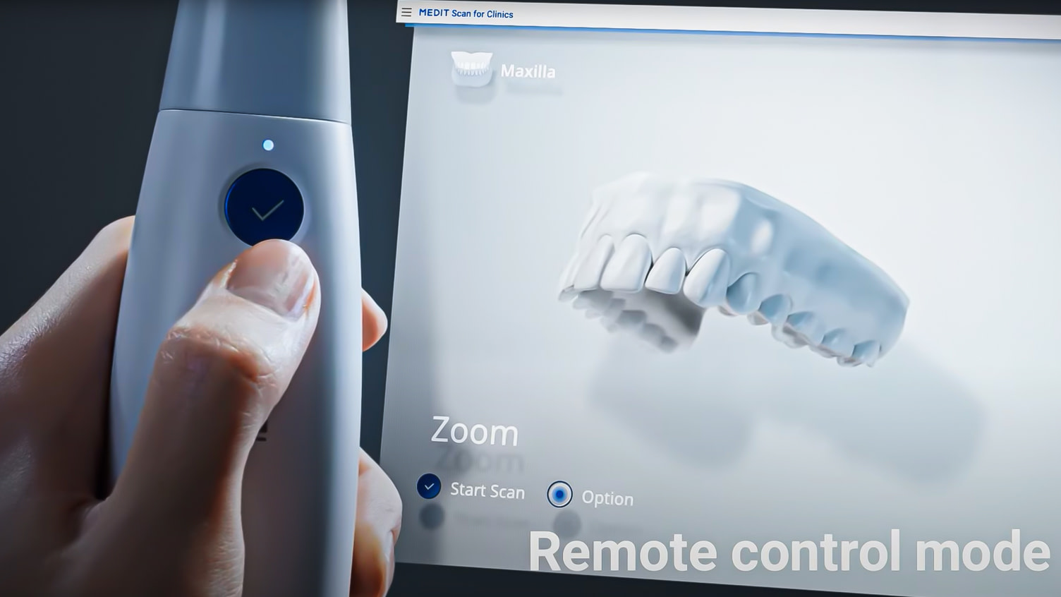 Launch of the Medit i700, specs and details - institute of digital dentistry (4)