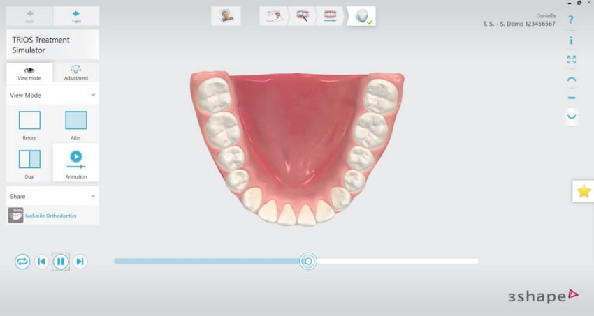 TRIOS Treatment SImulator