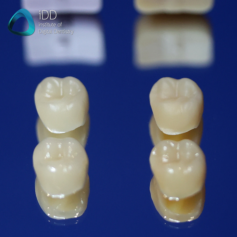 CEREC Tessera vs e.max CAD by Ivoclar Vivadent Institute of Digital Dentistry (5)