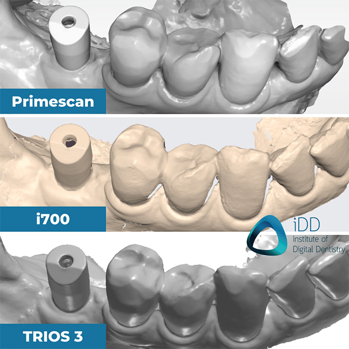 implant-scan-with-trios-medit-cerec-institute-of-digital-dentsitry (2)