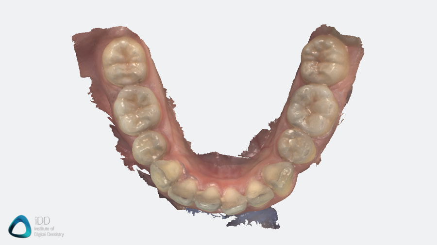 Heron Review Institute of Digital Dentistry Software (6)