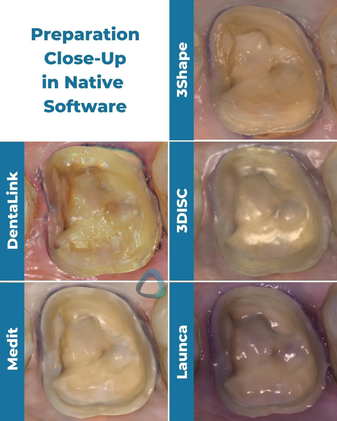 tooth-preparation-scan-trios-4-launca-dl-206p-dentalink-s6000-3disc-heron-medit-i700-colour