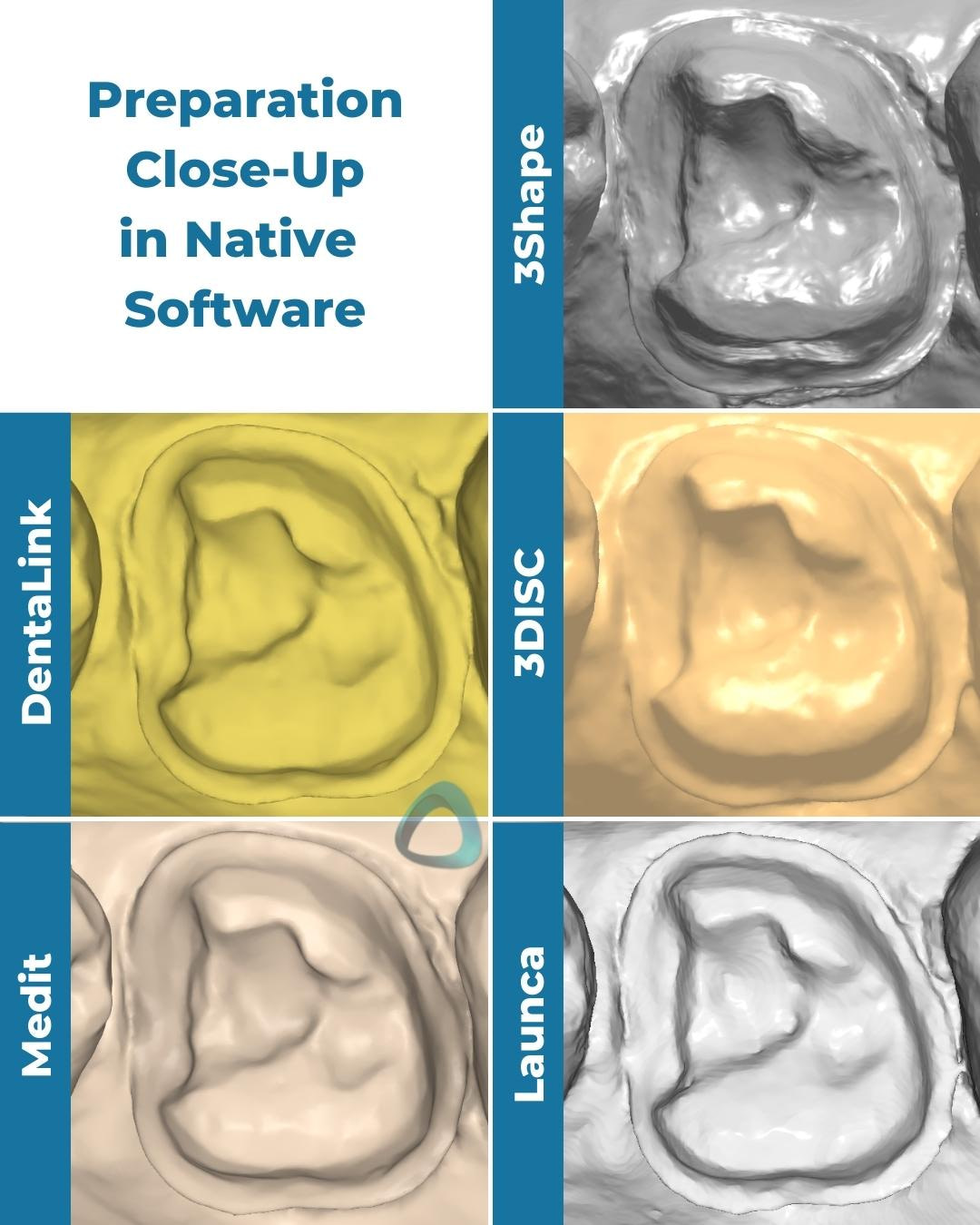 tooth-preparation-scan-trios-4-launca-dl-206p-dentalink-s6000-3disc-heron-medit-i700-monochromatic