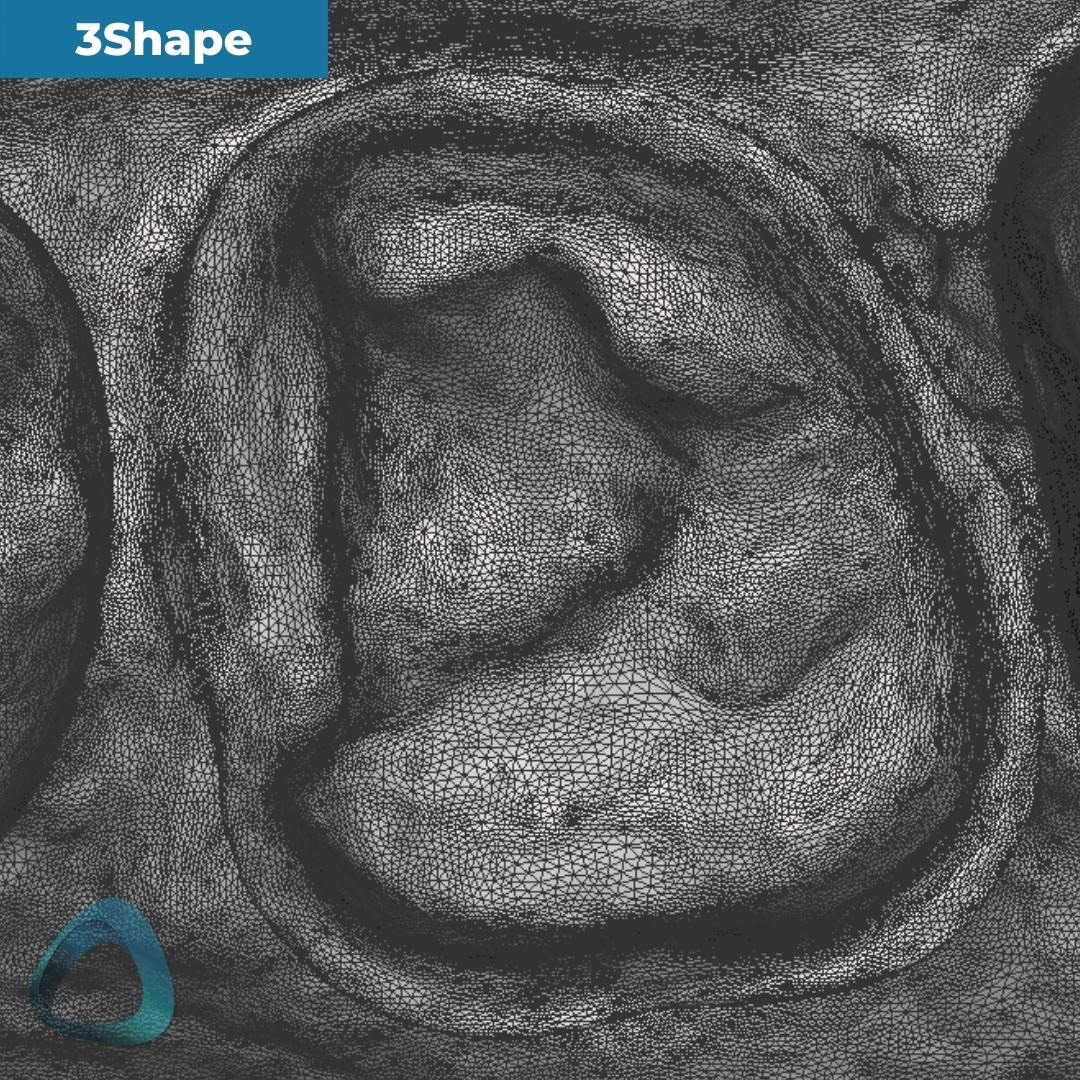 tooth-preparation-scan-with-3shape-trios-4