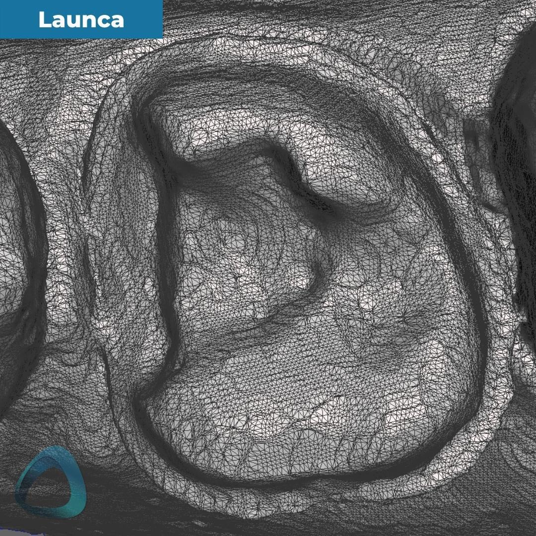 tooth-preparation-scan-with-launca-dl-206p