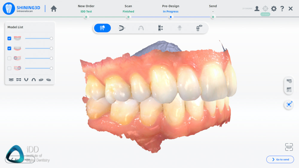 Shining_3D_Aoralscan_3_Review_cost_institute_of_digital_dentistry_ai (76)