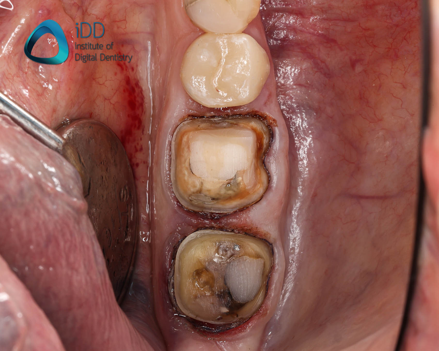 figure-11-pre-operative-photo