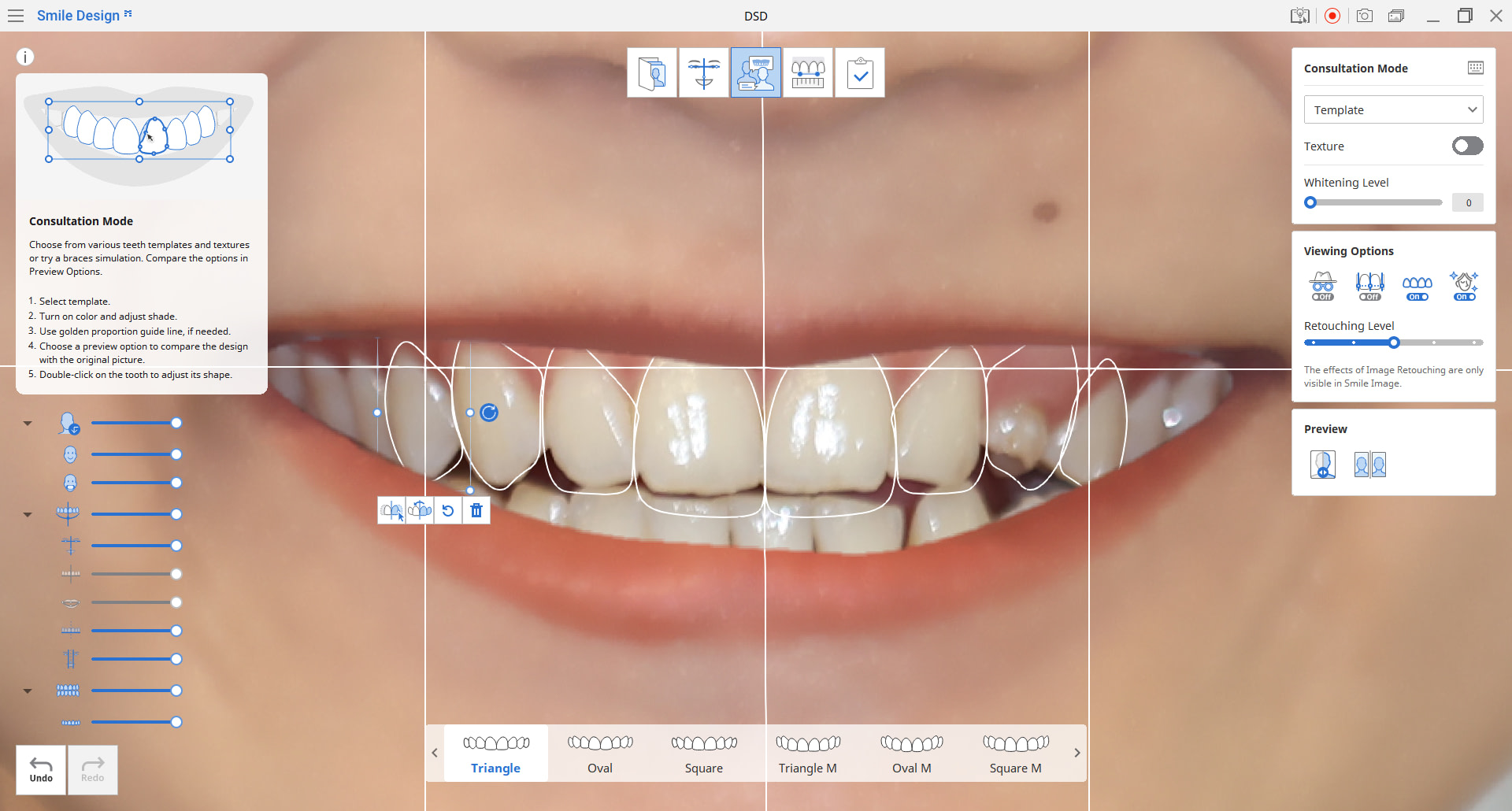 Medit-link-apps-smile-design