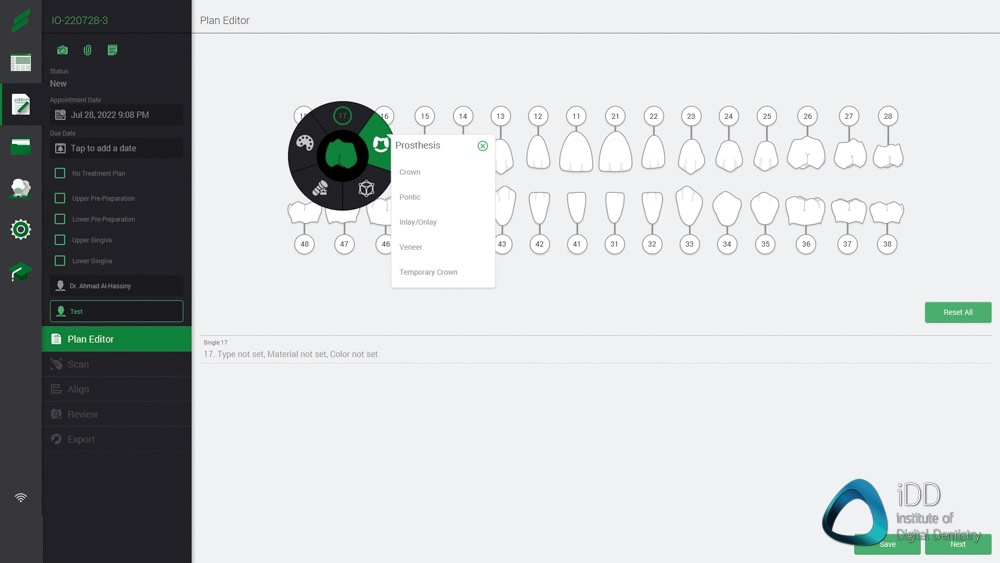 straumann virtuo vivo intraoral scanner review institute of digital dentistry (29)