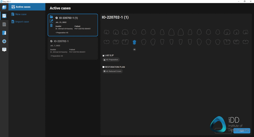 straumann virtuo vivo intraoral scanner review institute of digital dentistry (43)