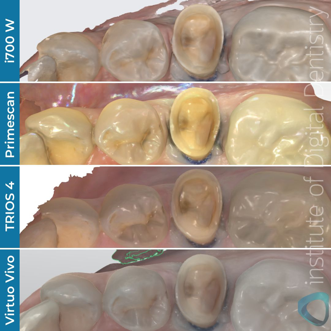 virtuo vivo review straumann institute of digital dentistry (1)