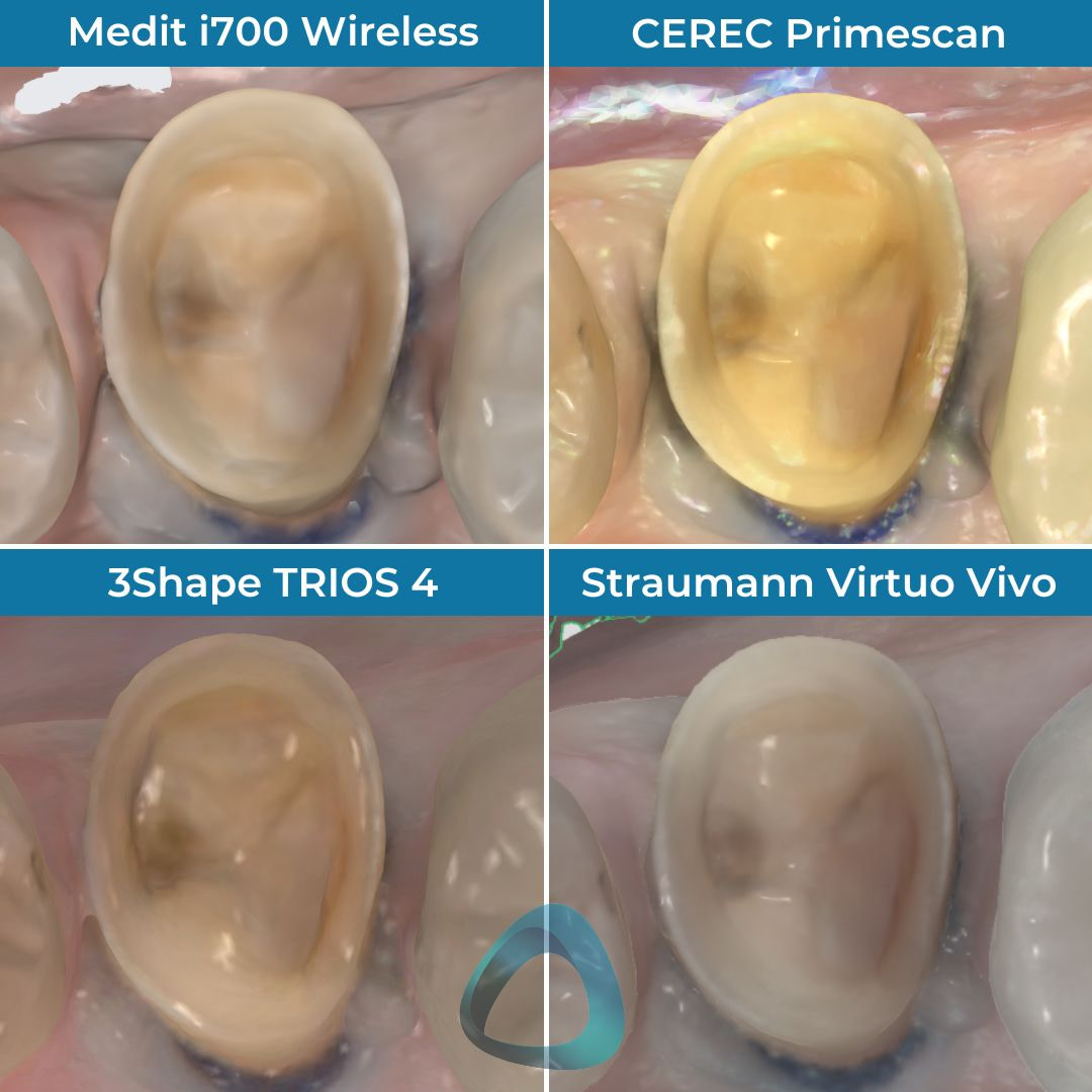 virtuo vivo review straumann institute of digital dentistry (2)