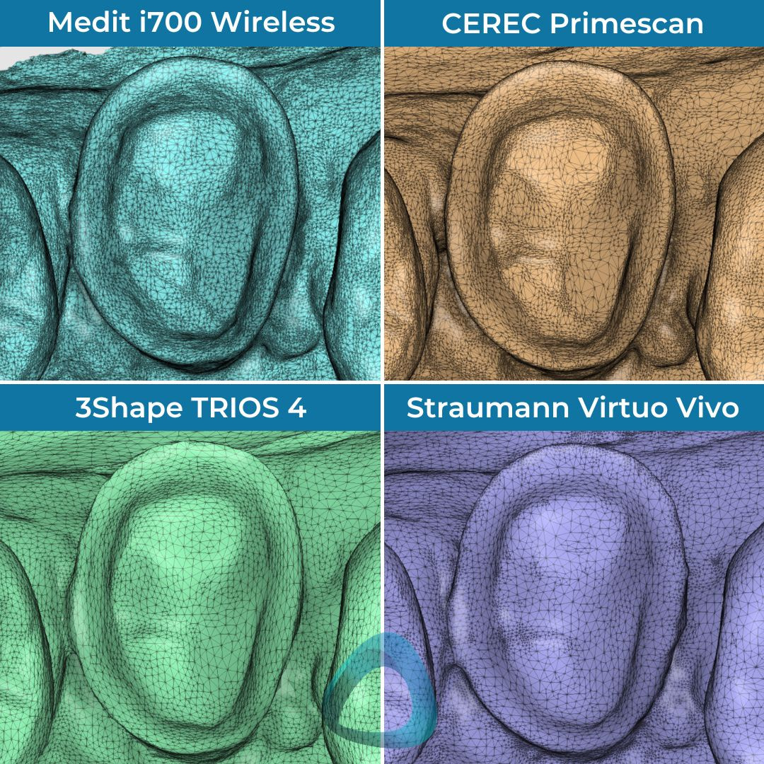 virtuo vivo review straumann institute of digital dentistry (3)