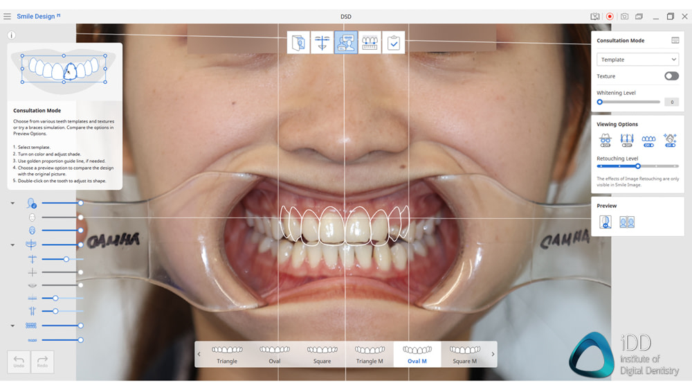medit apps i600 i500 i700 i700 wireless medit design medit temporaries medit compare medit splints (13)
