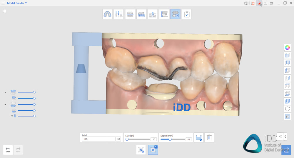 medit apps i600 i500 i700 i700 wireless medit design medit temporaries medit compare medit splints (6)