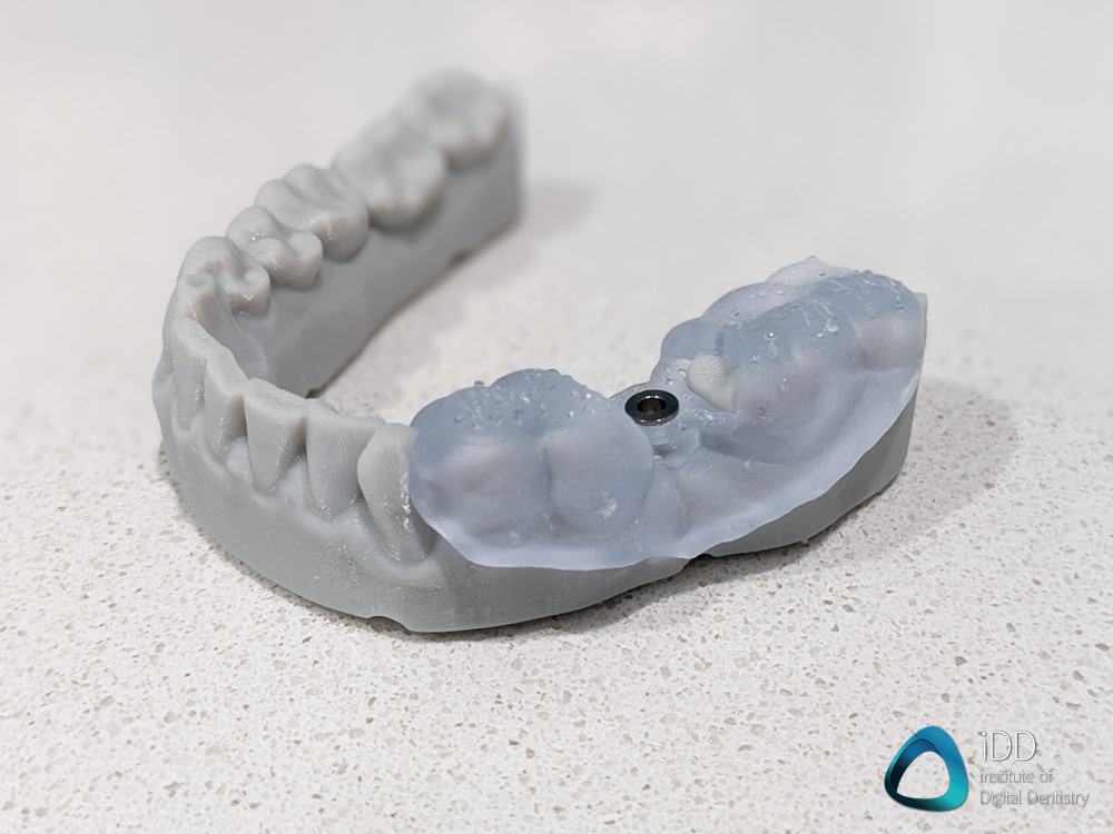 HeyGears UltraCraft Chairside 3D dental printer review (16)