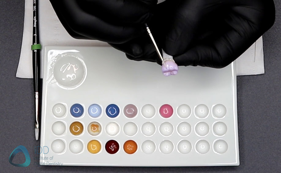 Staining-glazing-emax-idd