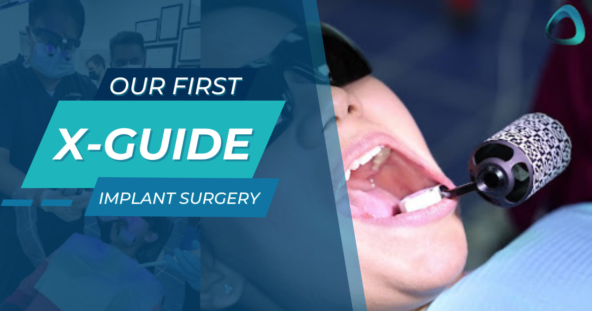 Our First X-Guide Implant Surgery - Institute of Digital Dentistry