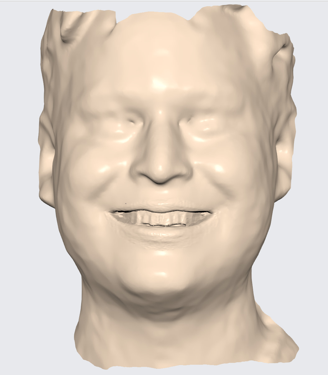 face scan comparison ply stl rayface dental (1)