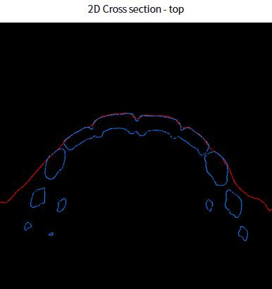 face scan intraoral scanner alignment (1)