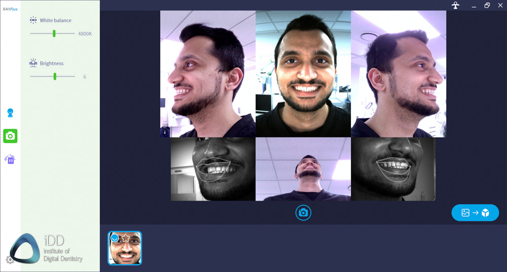 rayface face scanner software institute of digital dentistry (10)
