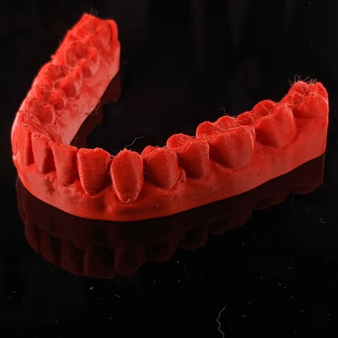 FDM printer dental model (1)