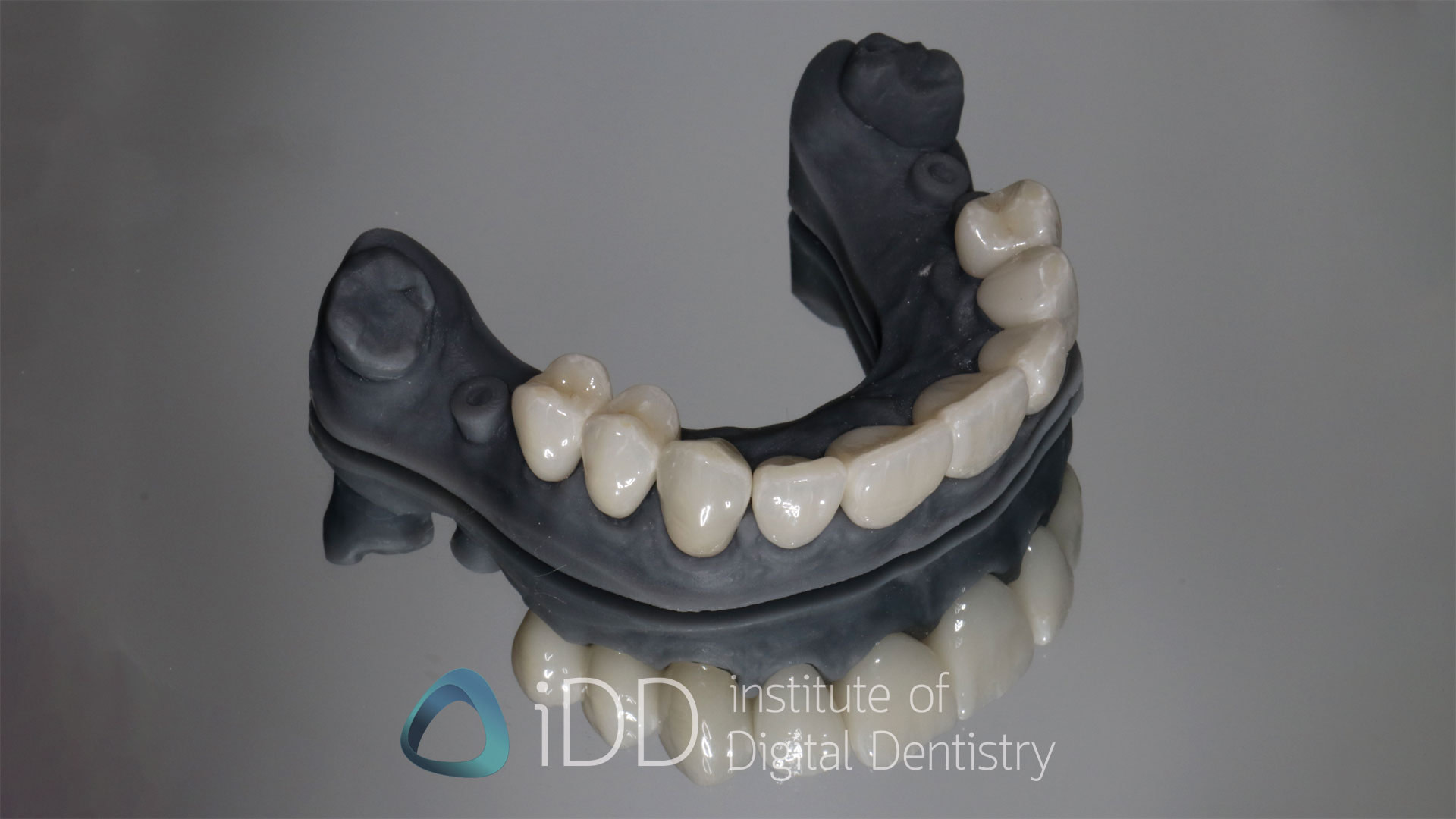 Fig-08-and-header-Peter-T-crowns-how-to-transition-into-digital-dentistry-workflows-watermarked