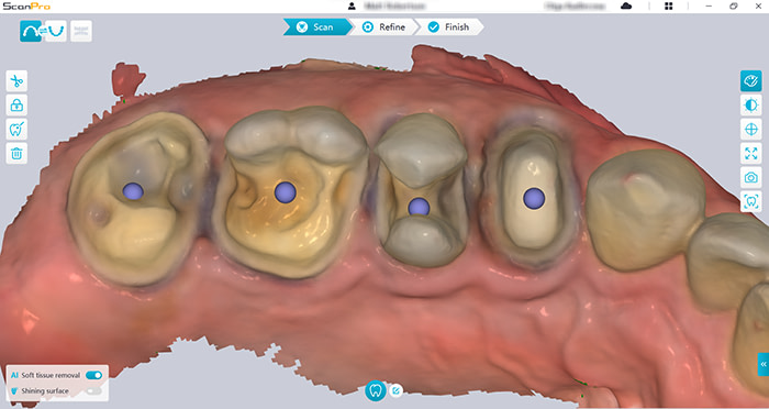 AS 200E MR preprocess color