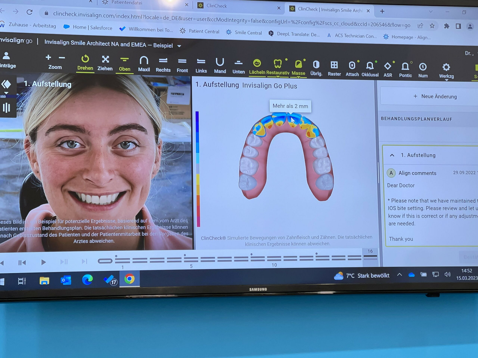 invisalign-smile-design-ai-generated-smile