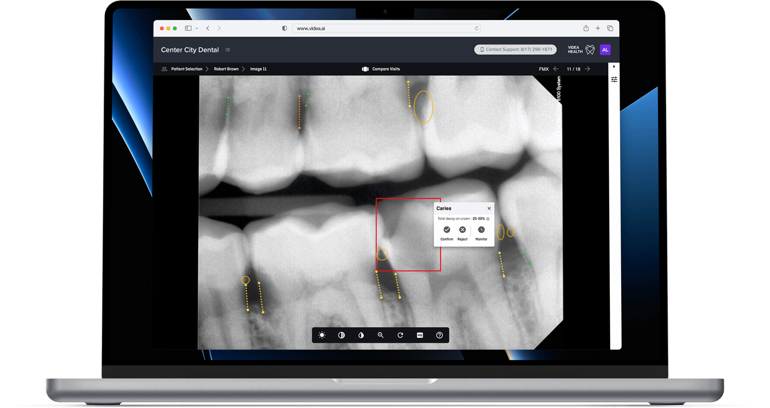 videa -641764893c99856cc91025f1_updated-bw-homepage