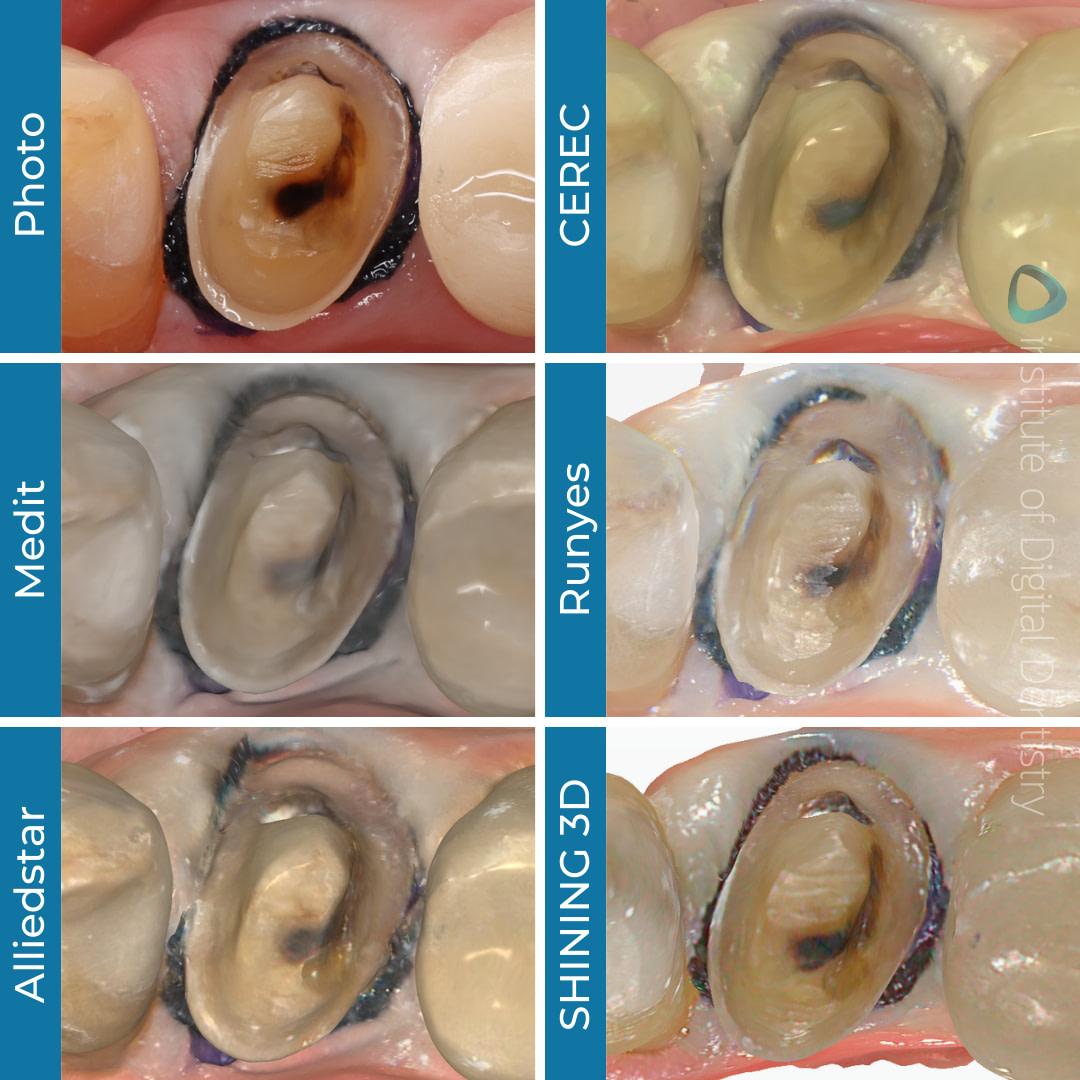 iDD-compares-photo-scan