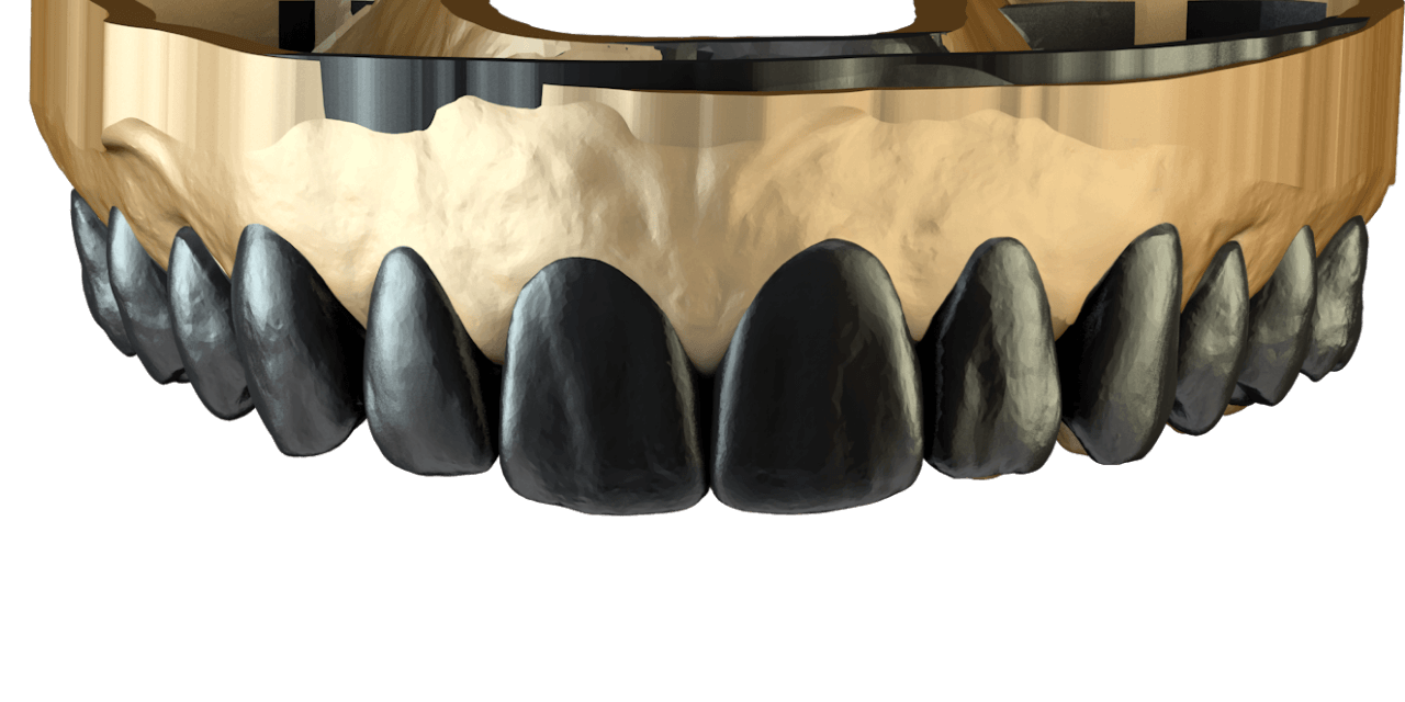 smilecloud-ai-smile-design