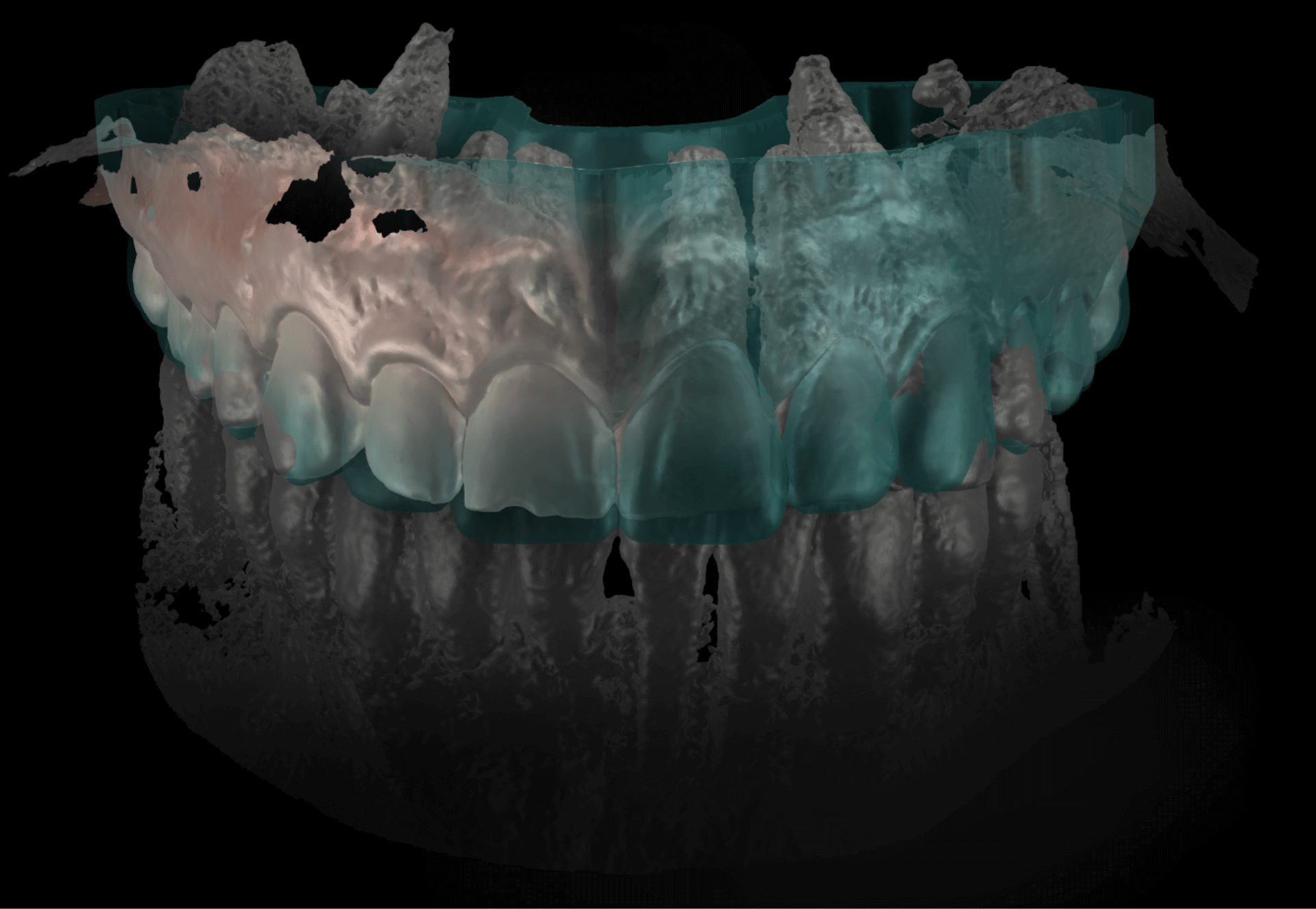 smilecloud-smile-design-ai