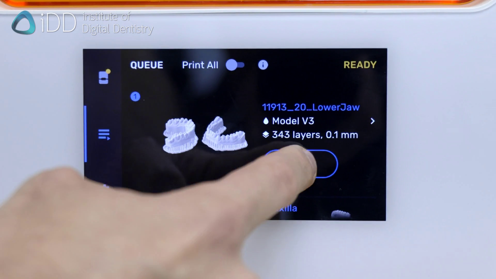 3d-printing-dental-model-idd-initiate-printing-process