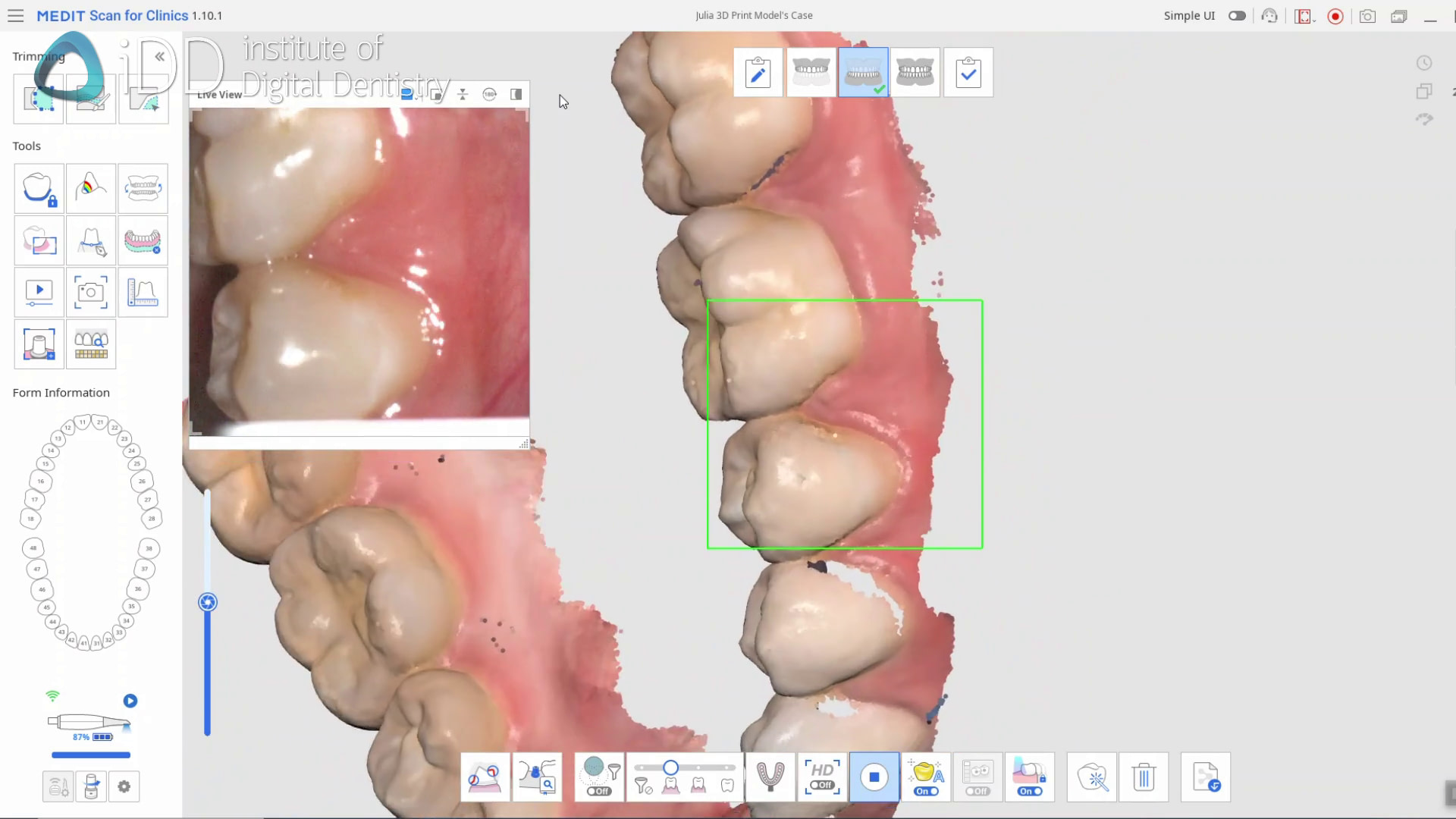 3d-printing-intraoral-scanning-digital-impression-medit-i700-wireless