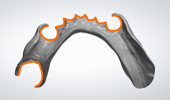 Graphy-support-placement