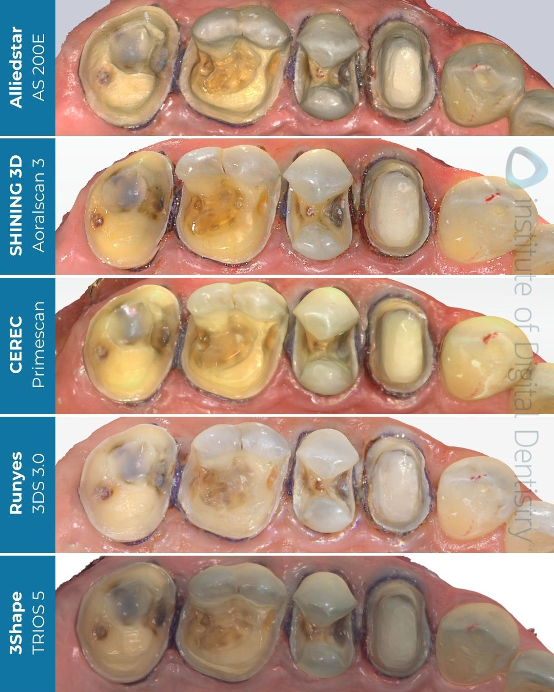 idd compares runyes cerec medit trios shining