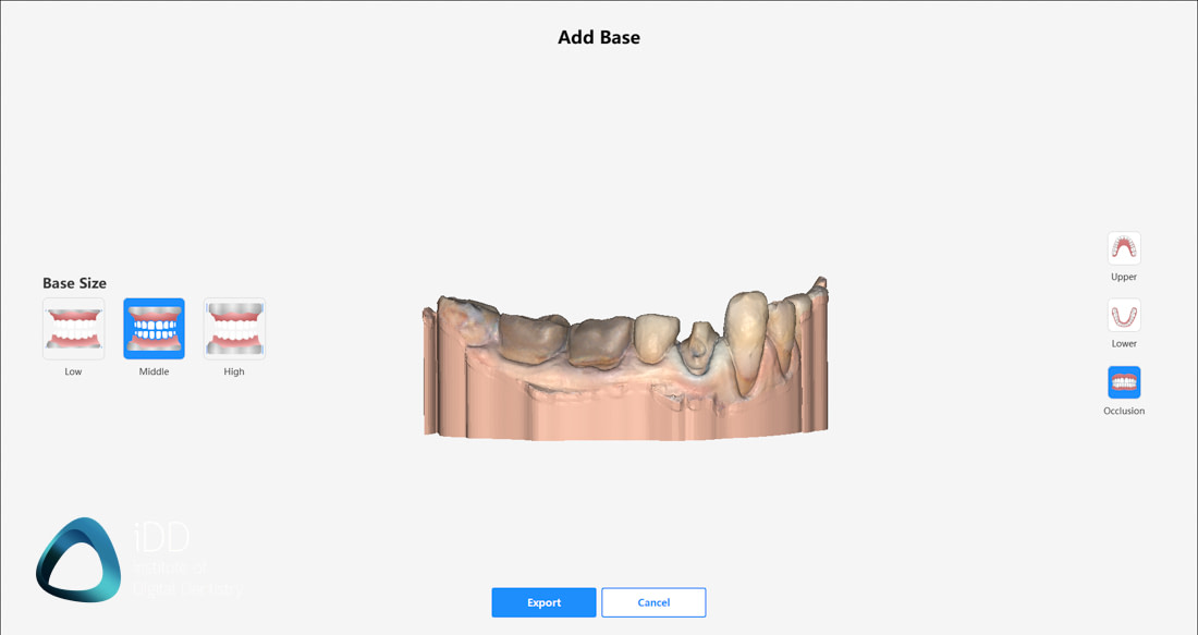 model builder runyes 3ds dental models
