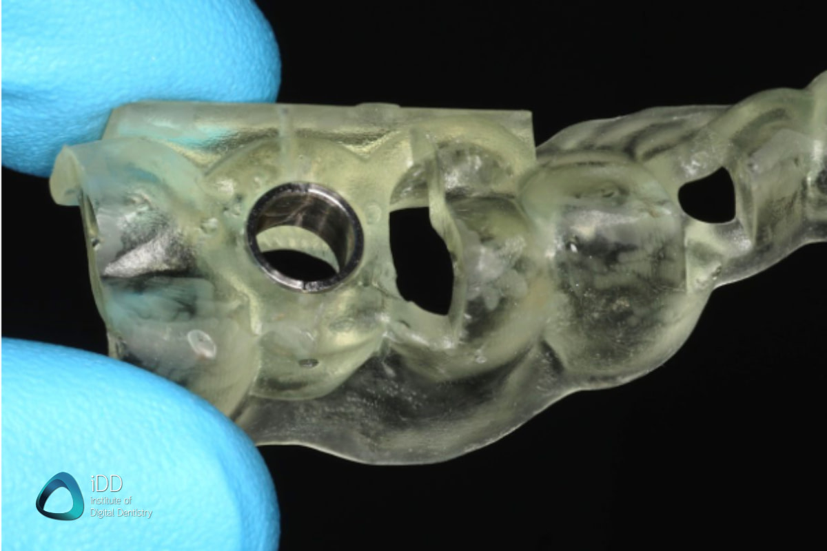 idd-3d-printed-surgical-guides-workflow-after-autoclave